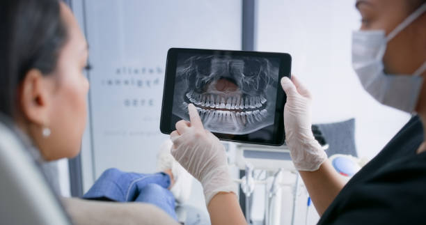 Licensed Root Canal Treatment service in Radford city County, VA - Smile Center Dentistry